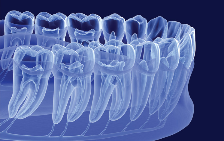 Treatment - Carnaby Street Dental