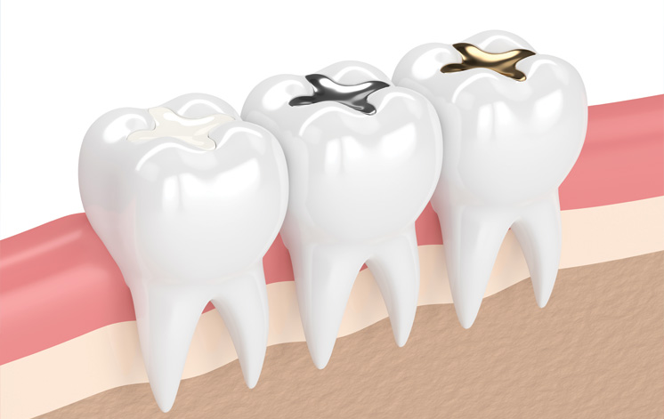 Treatment - Carnaby Street Dental